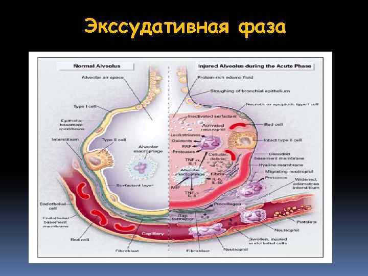 Экссудативная фаза 