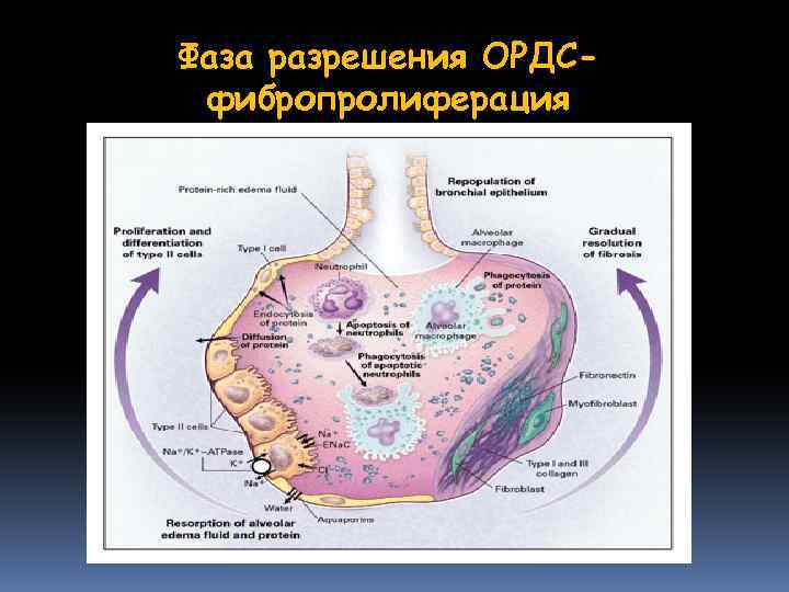 Фаза разрешения ОРДСфибропролиферация 