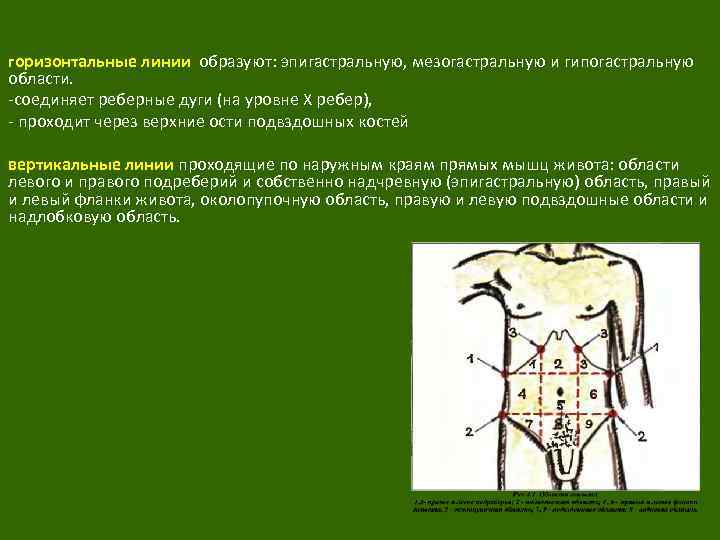 горизонтальные линии образуют: эпигастральную, мезогастральную и гипогастральную области. соединяет реберные дуги (на уровне X