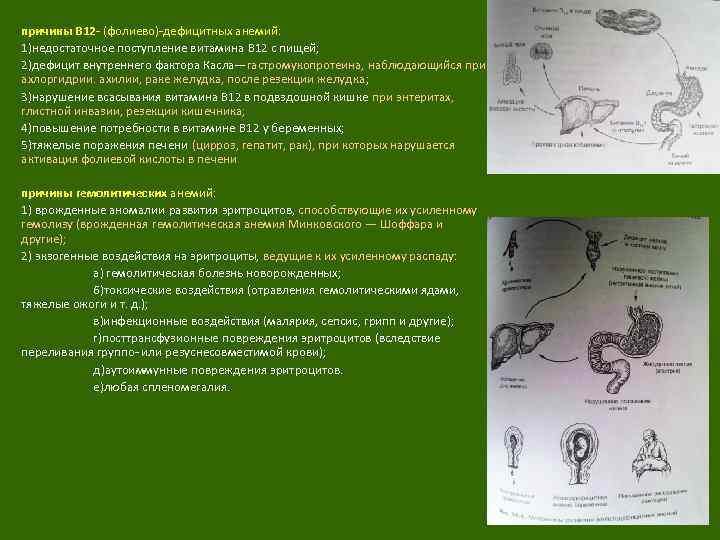 причины В 12 - (фолиево)-дефицитных анемий: 1)недостаточное поступление витамина В 12 с пищей; 2)дефицит