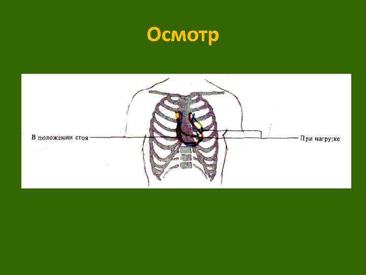 Осмотр 