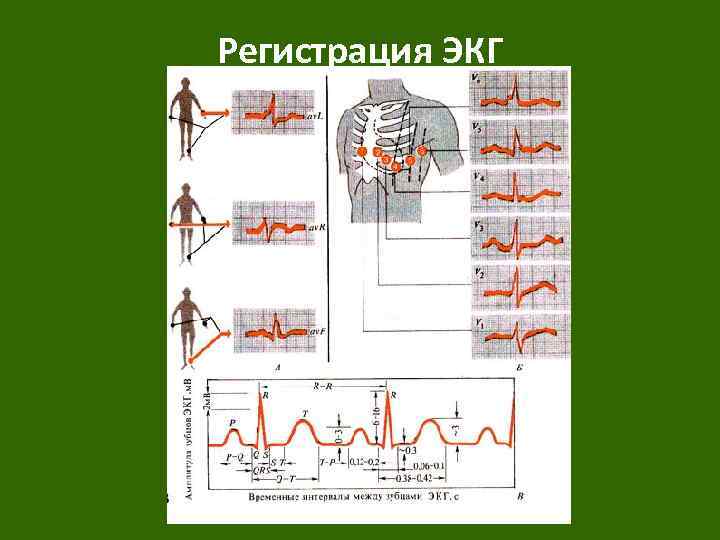 Регистрация ЭКГ 