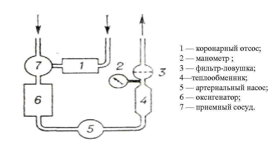 1 — коронарный отсос; 2 — манометр ; 3 — фильтр-ловушка; 4—теплообменник; 5 —