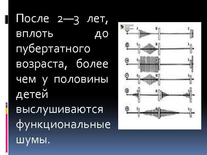 После 2— 3 лет, вплоть до пубертатного возраста, более чем у половины детей выслушиваются