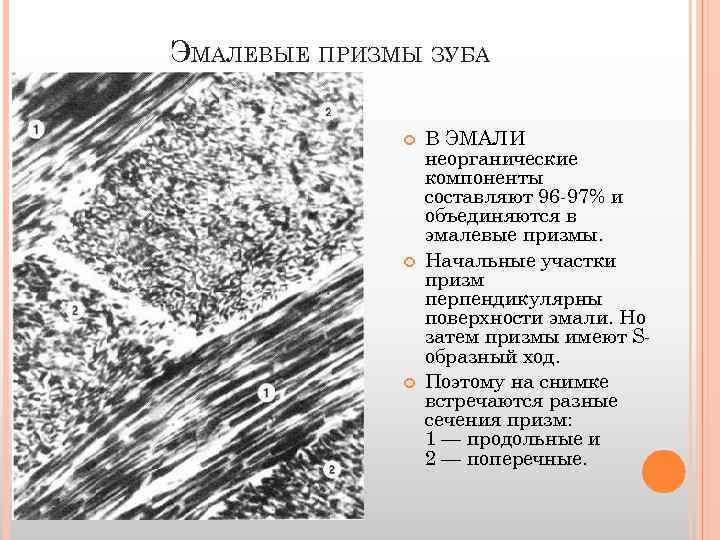 ЭМАЛЕВЫЕ ПРИЗМЫ ЗУБА В ЭМАЛИ неорганические компоненты составляют 96 -97% и объединяются в эмалевые