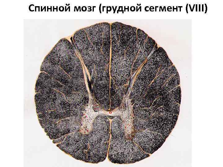 Спинной мозг (грудной сегмент (VIII) 