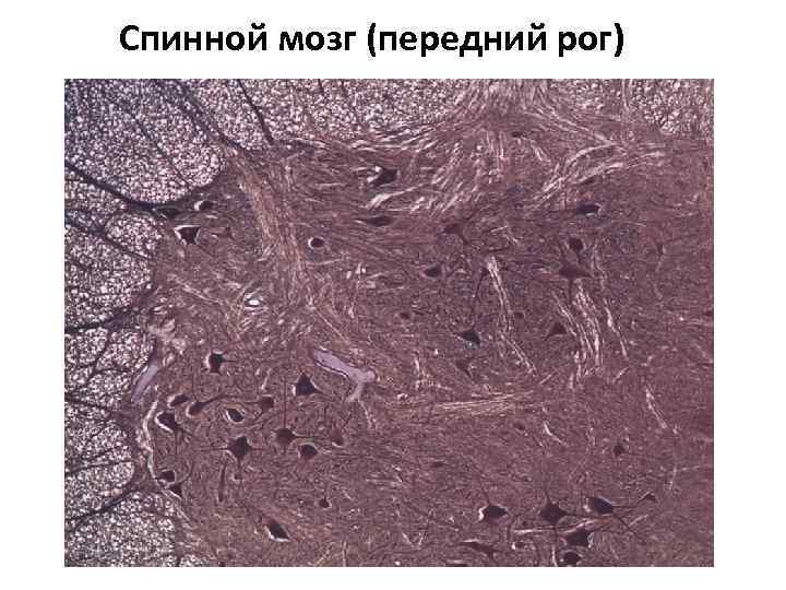 Спинной мозг (передний рог) 
