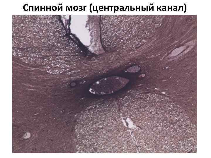 Спинной мозг (центральный канал) 