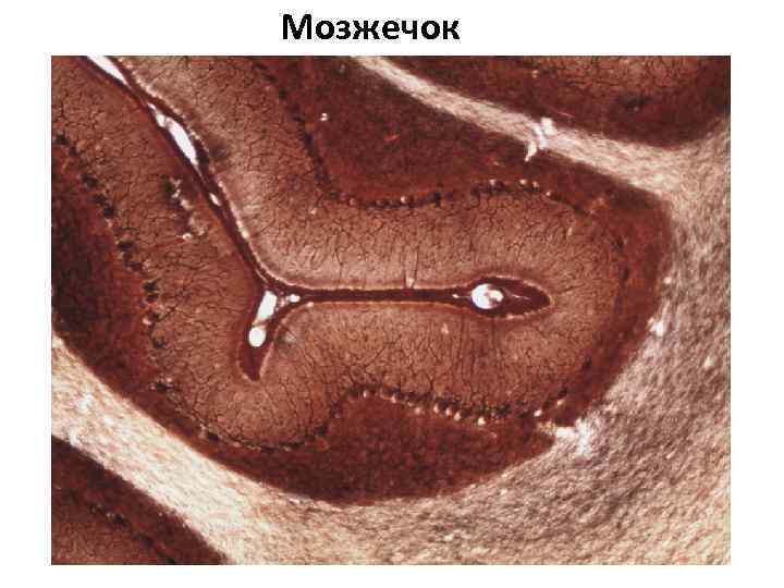 Мозжечок 