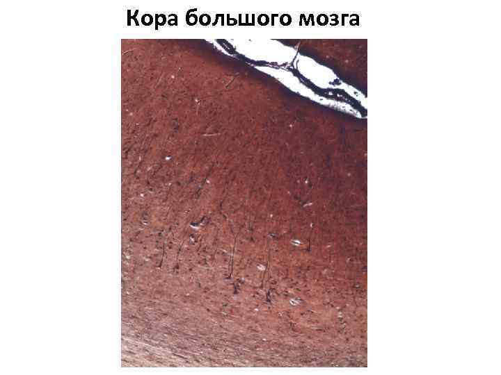Кора большого мозга 
