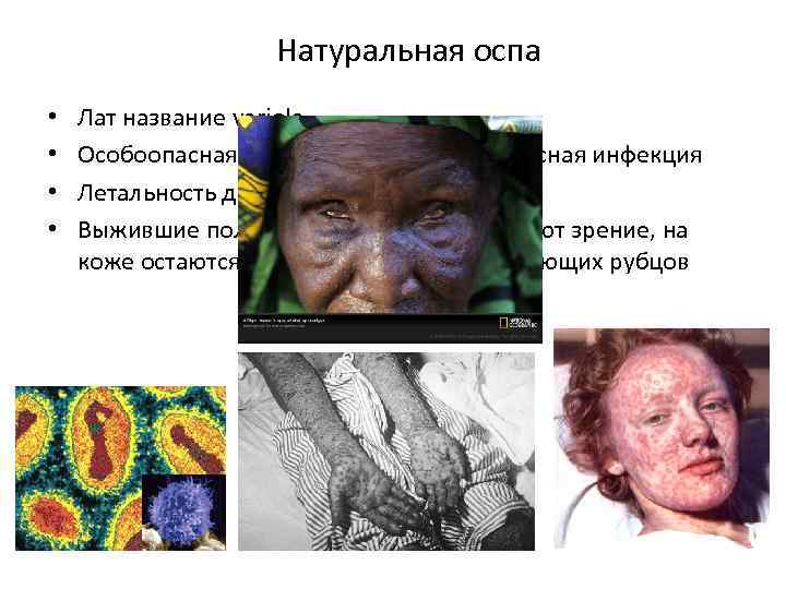Натуральная оспа • • Лат название variola Особоопасная воздушно-капельная вирусная инфекция Летальность до 90%