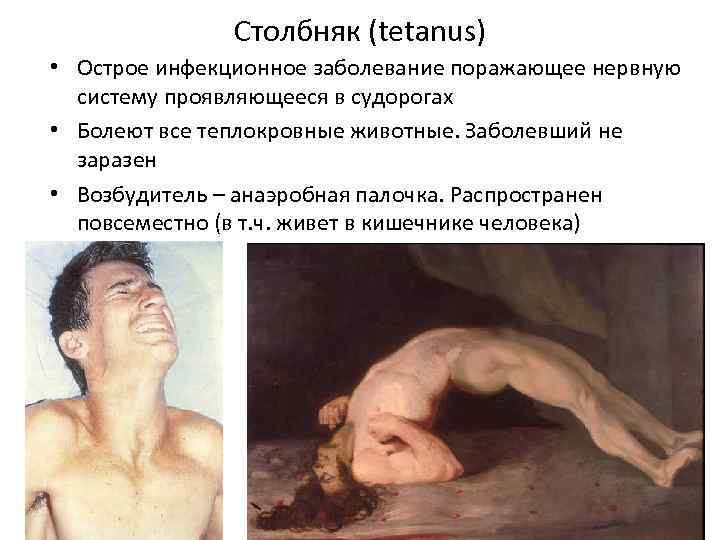 Столбняк (tetanus) • Острое инфекционное заболевание поражающее нервную систему проявляющееся в судорогах • Болеют