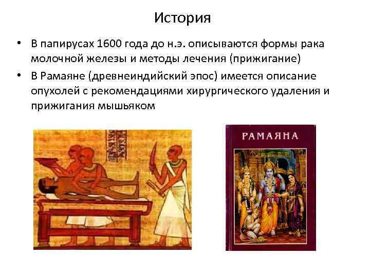 История • В папирусах 1600 года до н. э. описываются формы рака молочной железы