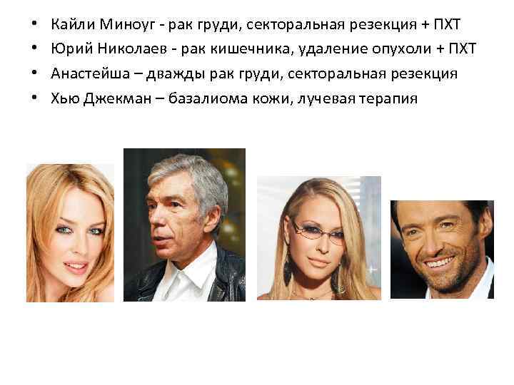  • • Кайли Миноуг - рак груди, секторальная резекция + ПХТ Юрий Николаев