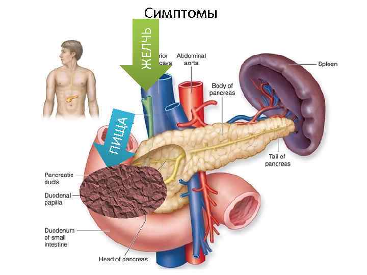 ПИЩ А ЖЕЛЧЬ Симптомы 