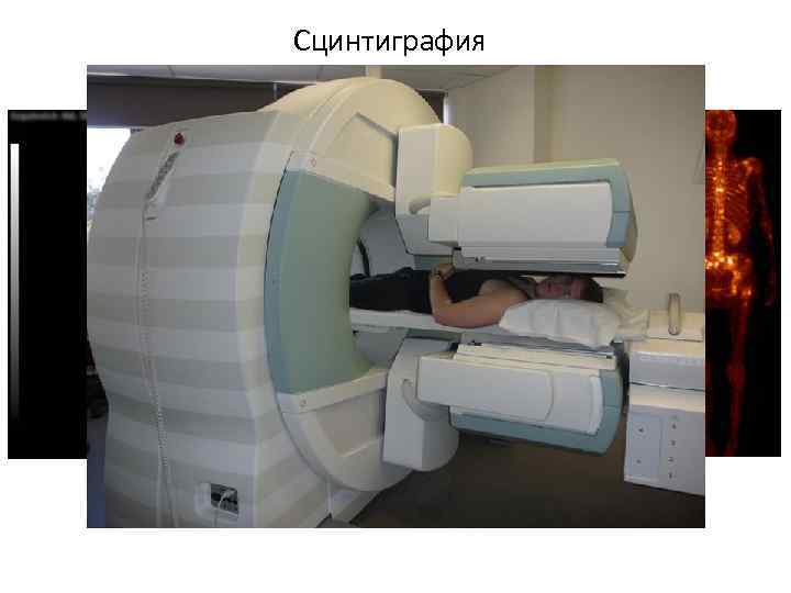 Сцинтиграфия 