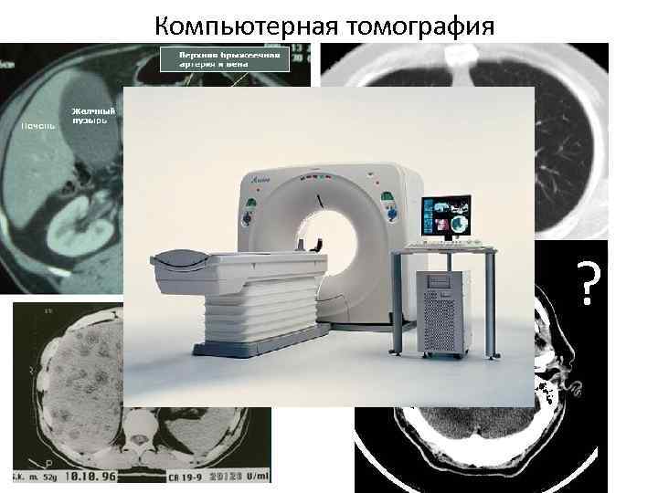 Компьютерная томография ? 
