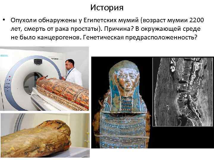 История рака