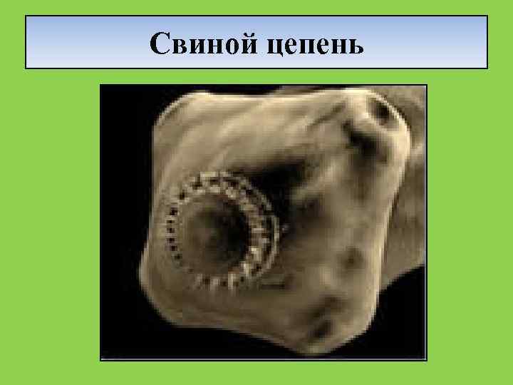 Свиной цепень 