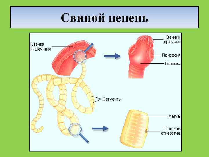 Свиной цепень локализация