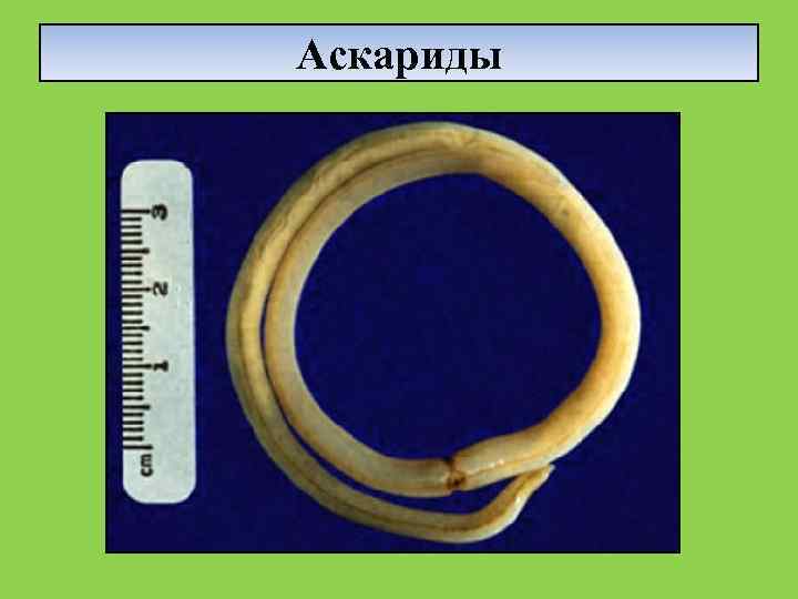Аскариды 