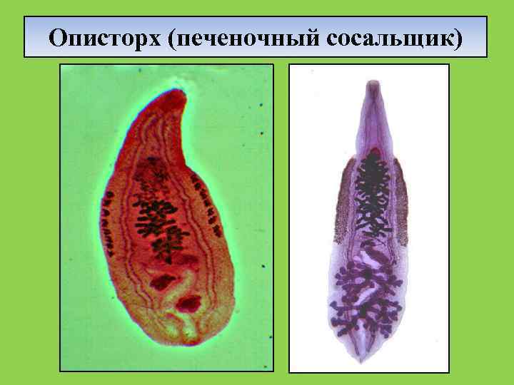Печеночный сосальщик фото