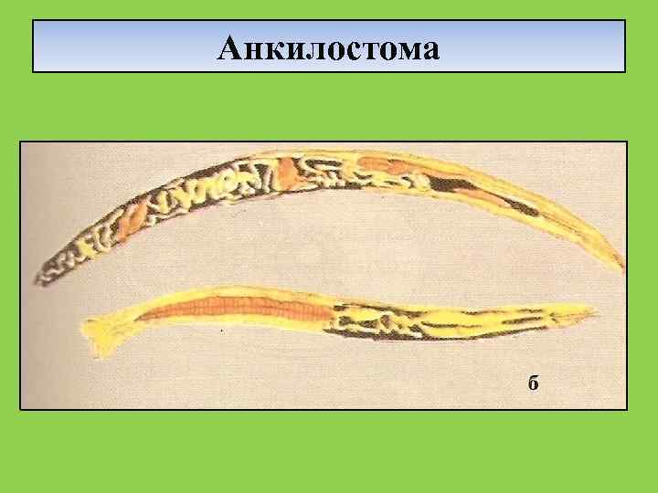 Анкилостома 