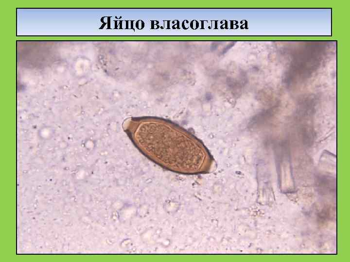 Яйцо власоглава 