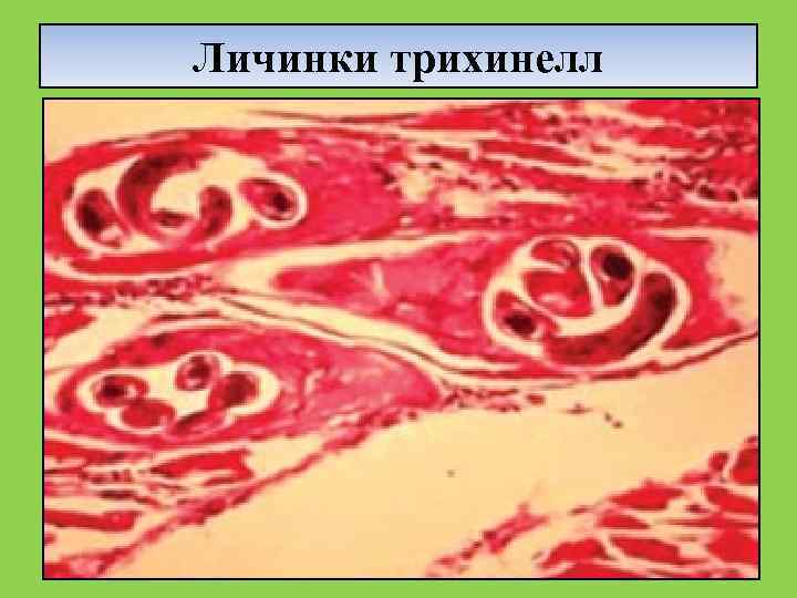 Личинки трихинелл 