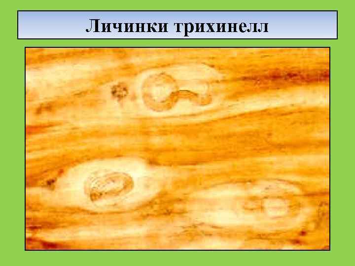 Личинки трихинелл 