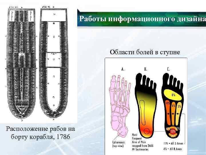 Работы информационного дизайна Области болей в ступне Расположение рабов на борту корабля, 1786 
