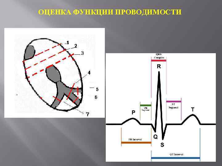 Проводимость на экг. Проводимость по ЭКГ. Оценка функции проводимости на ЭКГ. Электрокардиография функция проводимости. Оценка функциональной проводимости ЭКГ.