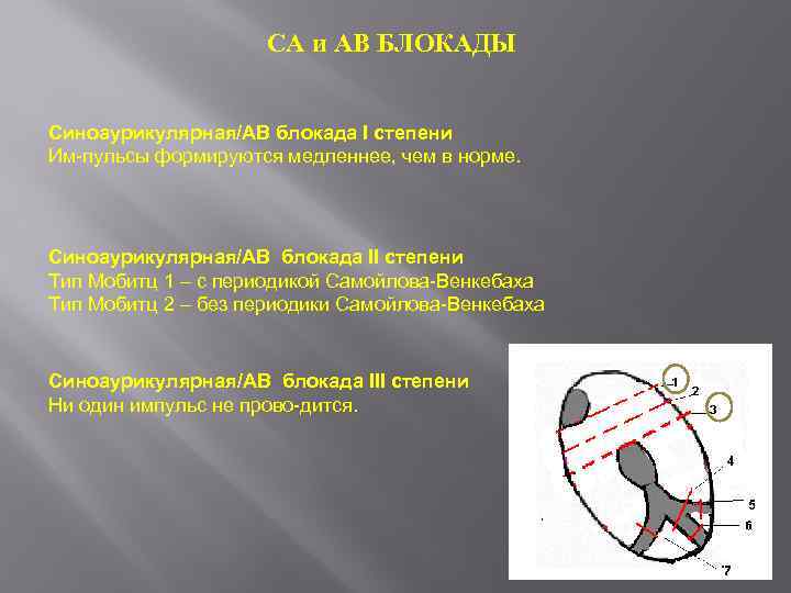 СА и АВ БЛОКАДЫ Синоаурикулярная/АВ блокада I степени Им пульсы формируются медленнее, чем в