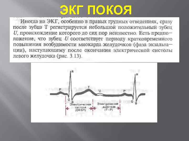 ЭКГ ПОКОЯ 