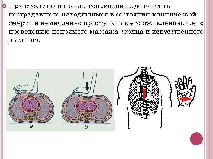 Тяжело включаются передачи нексия