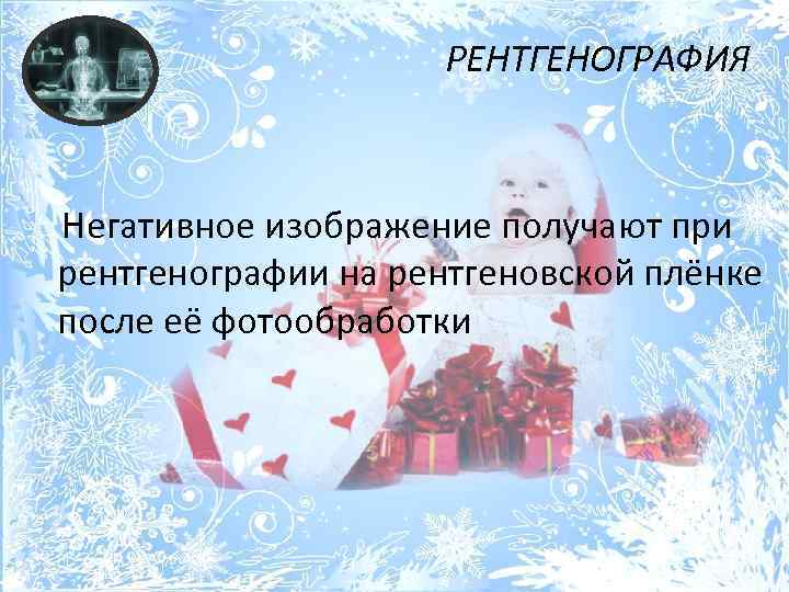 РЕНТГЕНОГРАФИЯ Негативное изображение получают при рентгенографии на рентгеновской плёнке после её фотообработки 