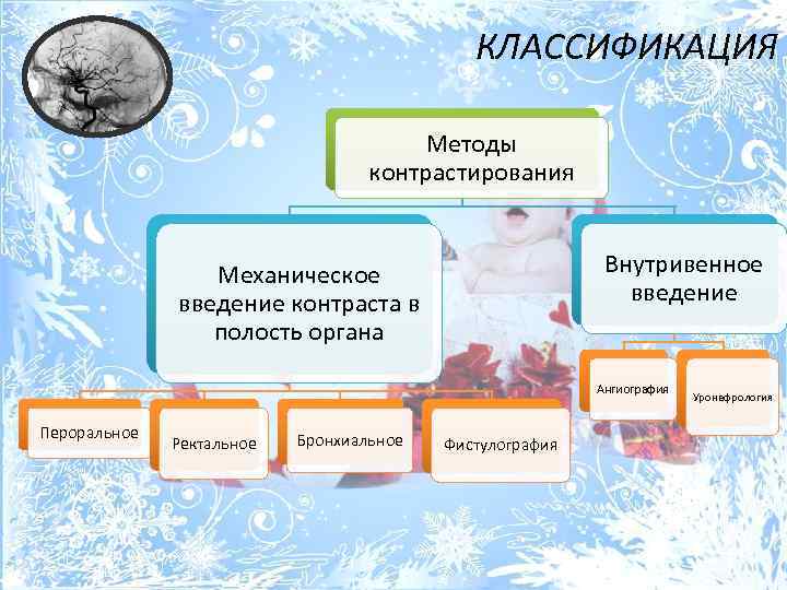 КЛАССИФИКАЦИЯ Методы контрастирования Внутривенное введение Механическое введение контраста в полость органа Ангиография Пероральное Ректальное