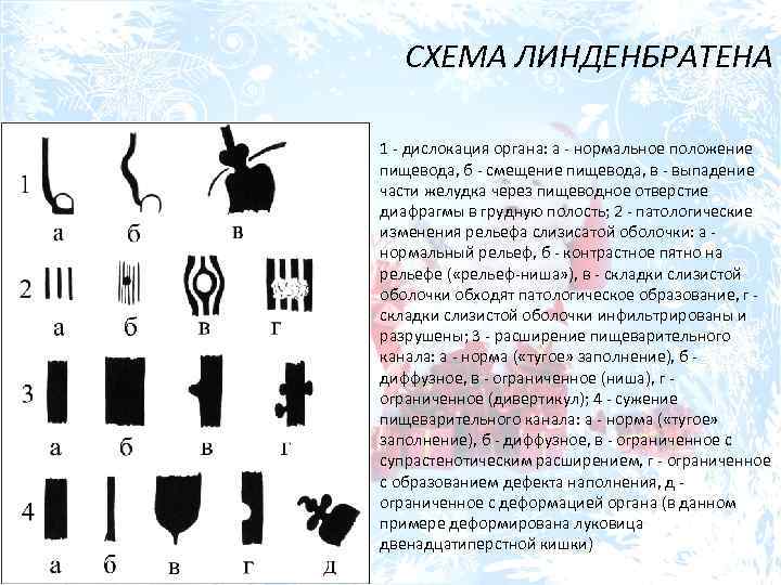 СХЕМА ЛИНДЕНБРАТЕНА 1 - дислокация органа: а - нормальное положение пищевода, б - смещение