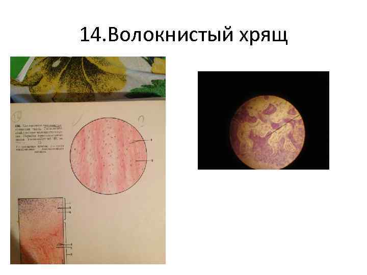 14. Волокнистый хрящ 