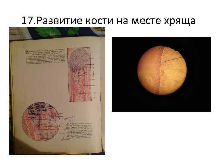 17. Развитие кости на месте хряща 