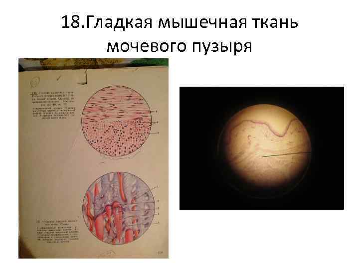 18. Гладкая мышечная ткань мочевого пузыря 