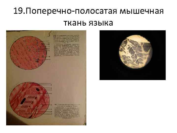 19. Поперечно-полосатая мышечная ткань языка 