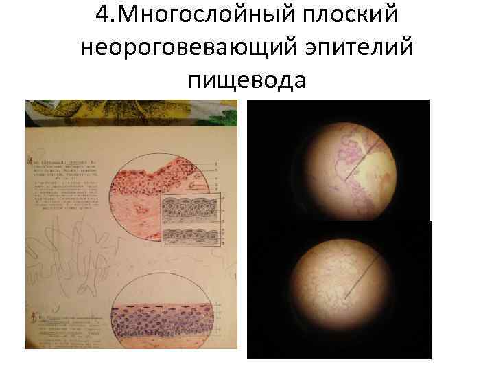 4. Многослойный плоский неороговевающий эпителий пищевода 