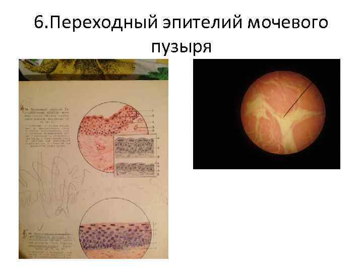 6. Переходный эпителий мочевого пузыря 