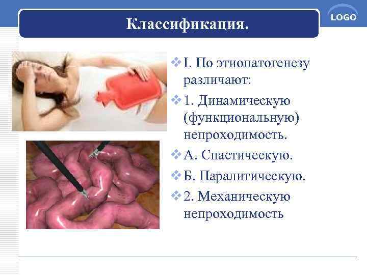 Классификация. v I. По этиопатогенезу различают: v 1. Динамическую (функциональную) непроходимость. v А. Спастическую.