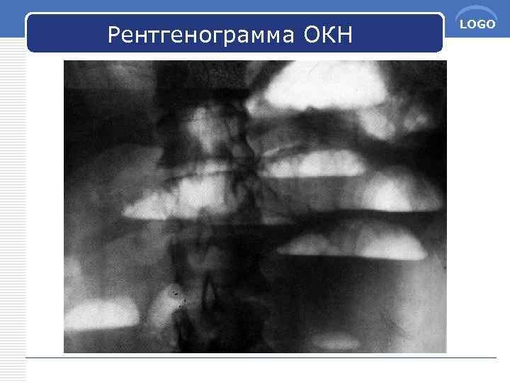 Рентгенограмма ОКН LOGO 