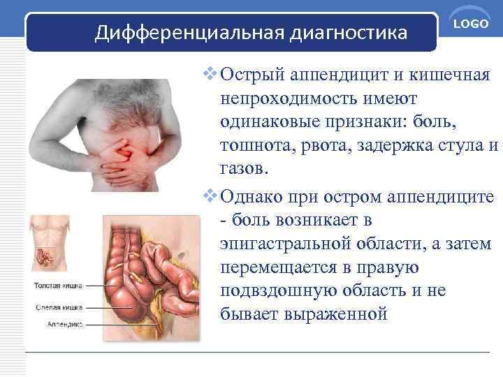 Дифференциальная диагностика LOGO v Острый аппендицит и кишечная непроходимость имеют одинаковые признаки: боль, тошнота,