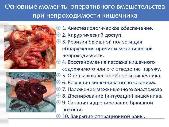Основные моменты оперативного вмешательства LOGO при непроходимости кишечника 1. Анестезиологическое обеспечение. 2. Хирургический доступ.