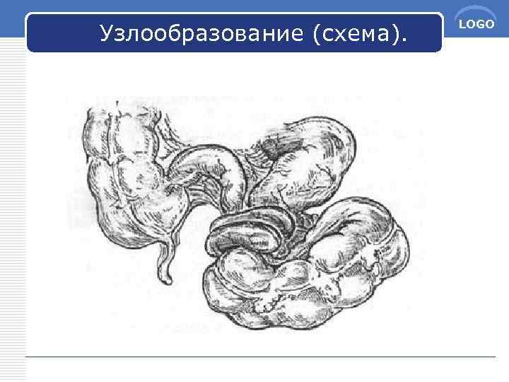 Узлообразование (схема). LOGO 