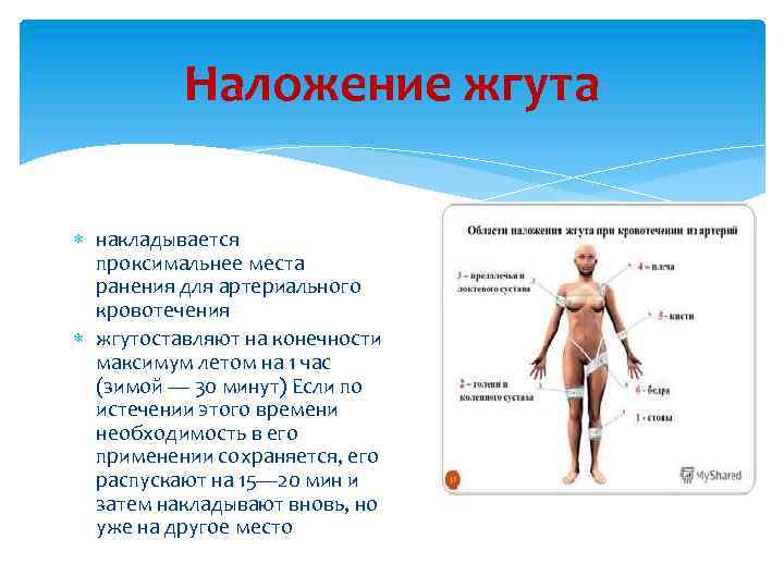 Наложение жгута накладывается проксимальнее места ранения для артериального кровотечения жгутоставляют на конечности максимум летом